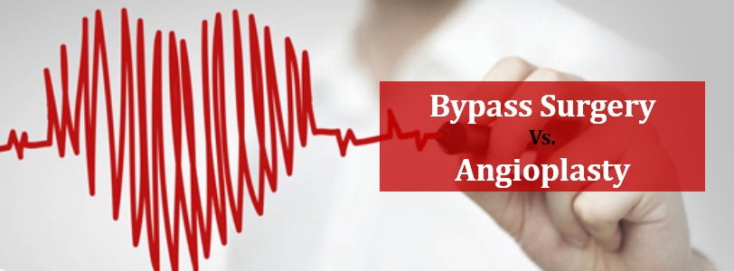 Angioplasty or Heart Bypass Surgery, Which is Better?